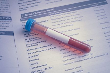 PFAS u krvi Gospićana: Ministarstvo neće uvoditi nacionalno testiranje